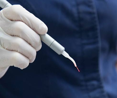 Gloved hand holding dental laser