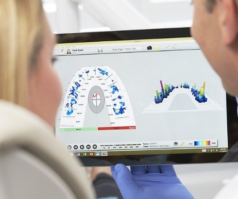 Dentist showing a patient advanced digital models of their teeth and bite