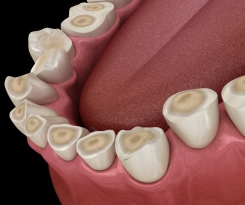 Animated row of short stubby teeth