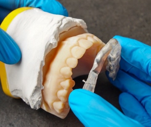 Dentist holding a model of the upper and lower arches of teeth