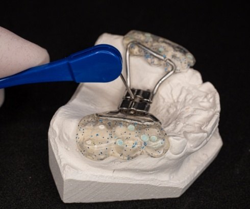 Dentist adjusting orthodontic appliance on model of upper dental arch
