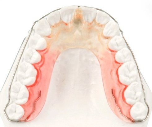 Model of arch of teeth with thin wire over all the teeth