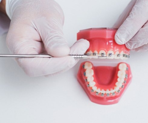 SiOrthodontist placing traditional braces on model of teeth