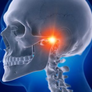 Digital illustration of a skull with a red light point over the TMJ area